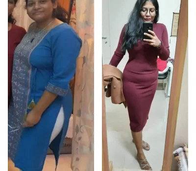 Meghna - PCOS Transformation - Before and After